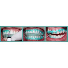 محافظ لثه لایت کیور BIODAM ?- مواد ترمیمی دندانپزشکی - ژل محافظ لثه biodinamica
